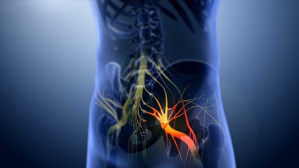 3D_still_showing_Sciatica_nerve